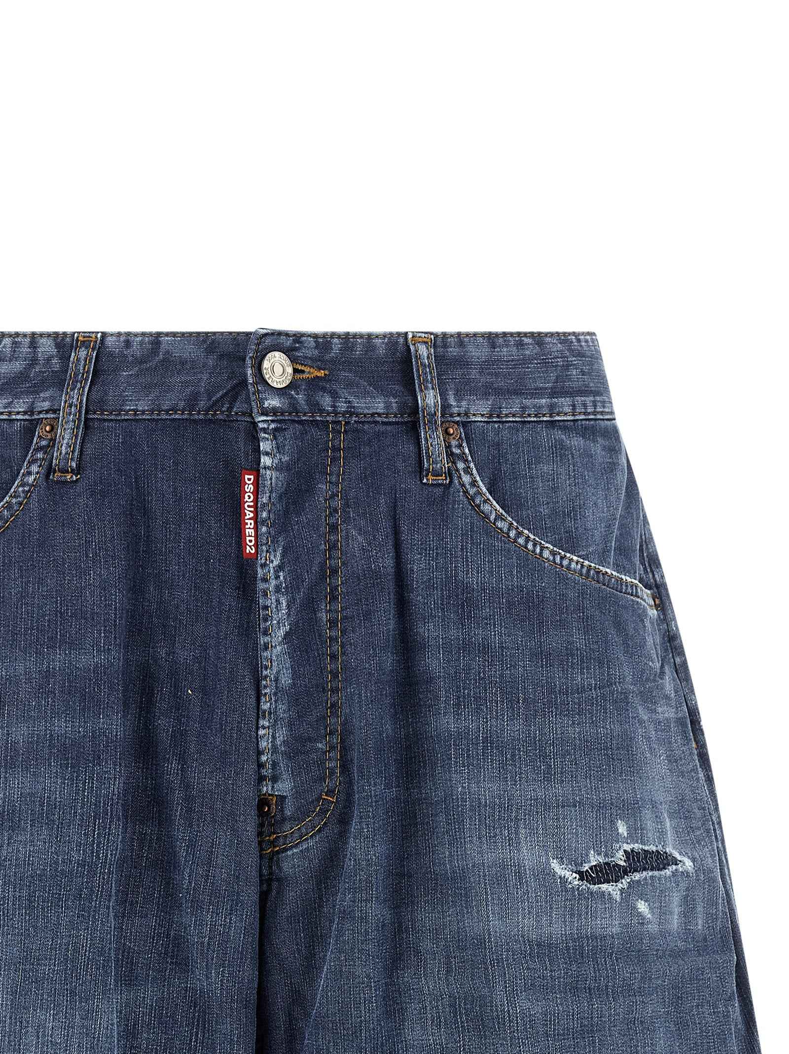 Dsquared² Blue Cotton Bermuda Shorts